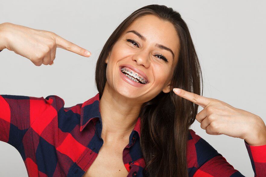 Top 10 Braces Questions and Answers