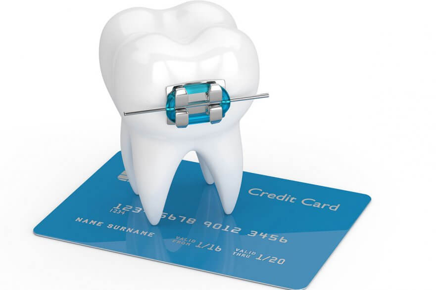 What is the Typical Cost of Getting Braces?